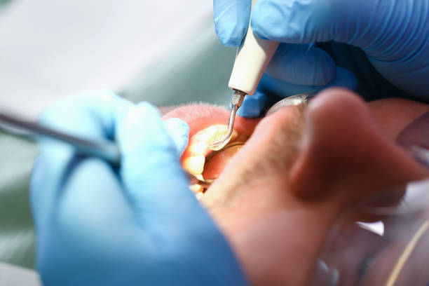 Best Urgent Care for Lost Fillings or Crowns in Mount Carmel, OH