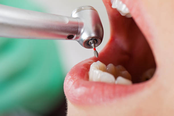 Best Emergency Denture Repair in Mount Carmel, OH